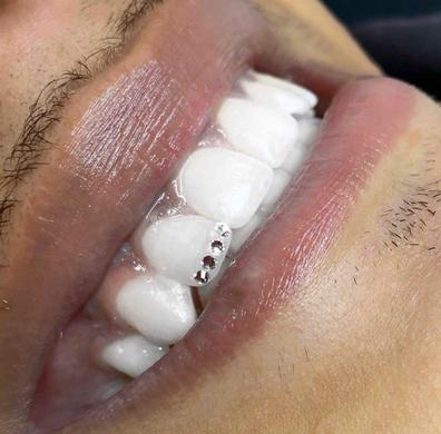 Juego de gemas dentales fáciles de quitar, joyería Dental blanca