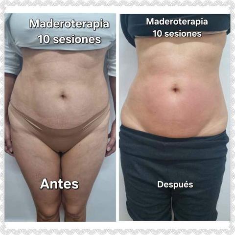 Milanuncios Maderoterapia corporal