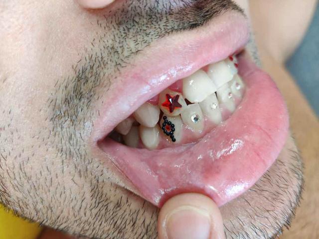 Milanuncios - Gemas dentales & cursos toothgems Madrid
