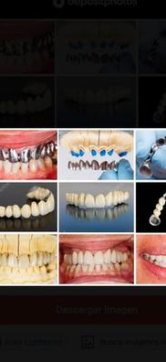 Clinica dental Ofertas de en Barcelona. Buscar y encontrar | Milanuncios