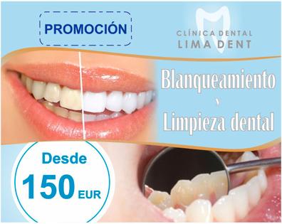 Blanqueamiento dental Dentistas y clínicas dentales baratas y con ofertas |  Milanuncios