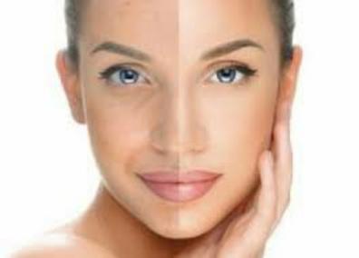 Tratamiento Facial Para Hombres Limpieza facial completa con opción a  radiofrecuencia. Limpieza Facial Completa Hombre Limpieza Completa