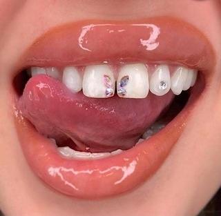 Milanuncios - Gemas dentales