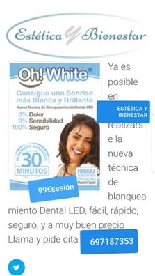 Milanuncios - Gemas dentales